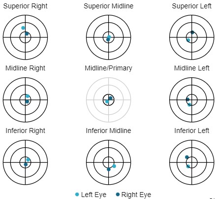 Release 5.7 9 pt motor function midline primary target change.jpg